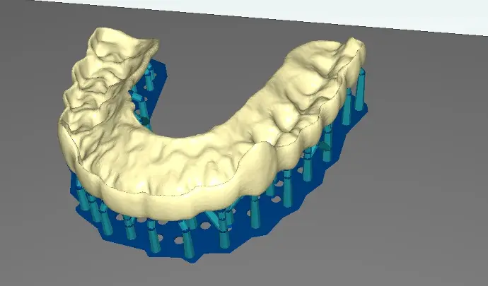 diseño dental exocad Centro dental cad cam