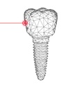 Puentes y coronas de Zirconio monolitico